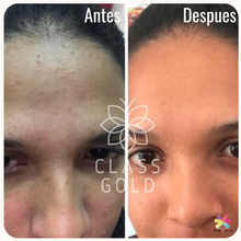 Cargar imagen en el visor de la galería, Jabón Para Piel Seca o Mixta Class Gold