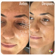 Cargar imagen en el visor de la galería, Kit Facial Antimanchas Class Gold Mas Obsequio