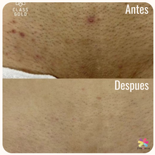 Cargar imagen en el visor de la galería, Kit Dermo 60ml, Jabón y Desodorante Intimo Class Gold