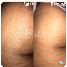 Cargar imagen en el visor de la galería, Kit Dermoaclarante 60ml y Desodorante Intimo Class Gold