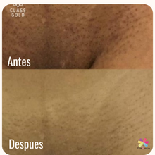 Cargar imagen en el visor de la galería, Kit Dermo 60ml, Jabón y Desodorante Intimo Class Gold