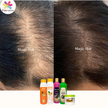 Cargar imagen en el visor de la galería, Acondicionador Anticaída Magic Hair