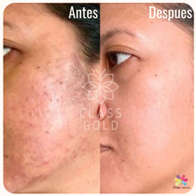 Cargar imagen en el visor de la galería, Mascarilla soft face Class Gold