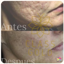 Cargar imagen en el visor de la galería, Mascarilla soft face Class Gold