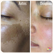 Cargar imagen en el visor de la galería, Tónico aclarante facial Class Gold 25ml