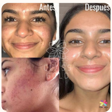 Cargar imagen en el visor de la galería, Tónico aclarante facial Class Gold 25ml